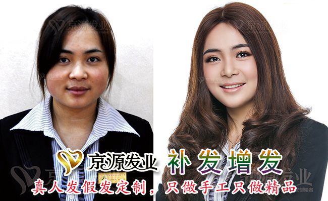 假发在哪里有卖？购买假发认准京源(图2)