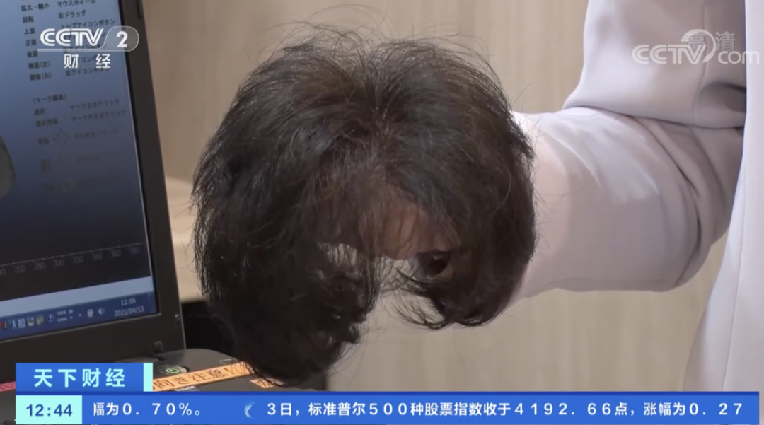 Emc易倍体育：太“秃”然！销量暴涨！有的假发戴在头上清洗也不怕掉落！价格是…(图5)