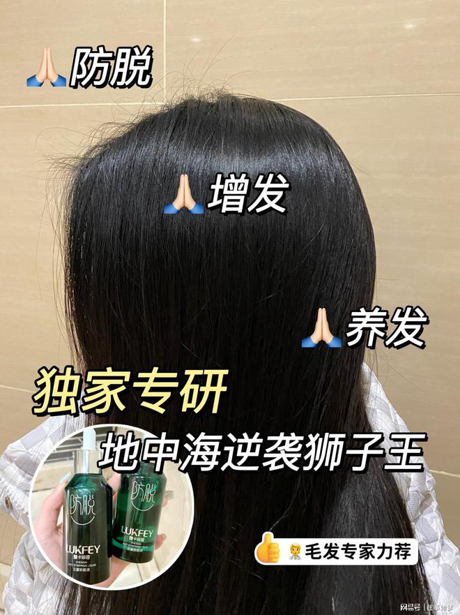防脱生发口碑最好的产品是什么？实测n款防脱好物合集(图2)