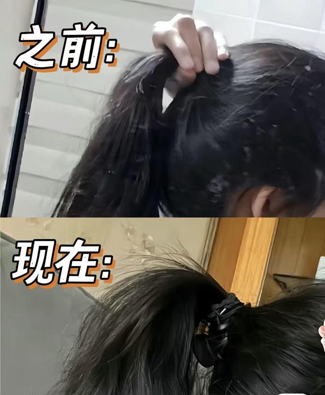 防脱发育发洗头膏排行榜前五名！用了变发量王者！(图4)