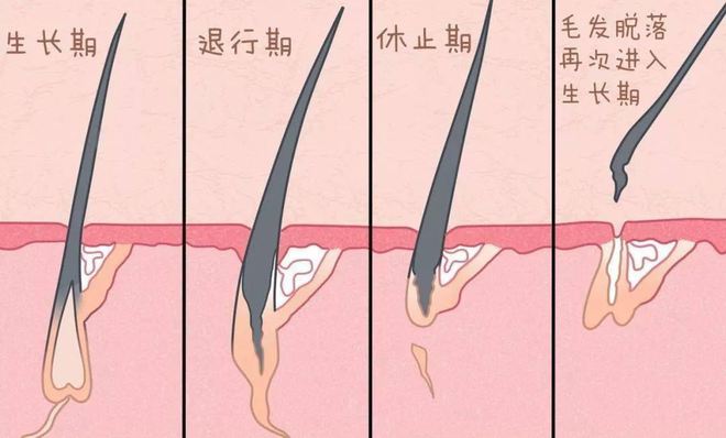 男士戴假发需要剃发吗？【知识科普】(图3)