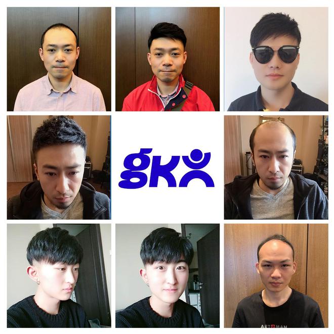 男士戴假发需要剃发吗？【知识科普】(图2)