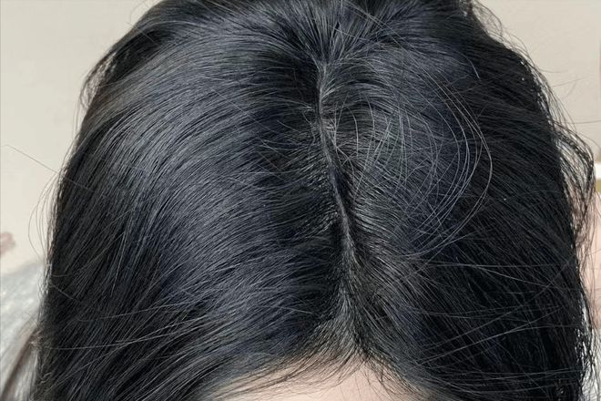 长出小碎发的关键是养气血？过来人的育发经验脱发女孩快看！(图4)