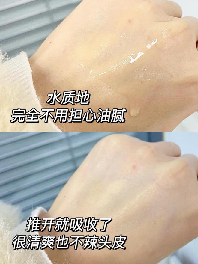 防脱育发哪个牌子最有效？国货新起之秀爱了！(图4)