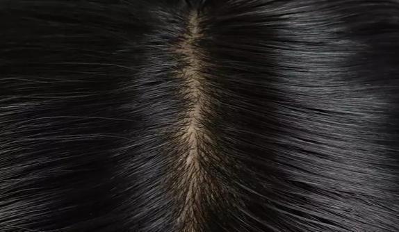 女生可以剃光头天天戴假发吗？该如何挑选、护理假发？(图3)