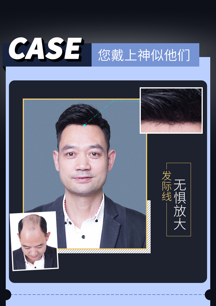 Emc易倍体育：假发中老年人-沈阳韩艺家真发发片-保证效果真实自然(图1)
