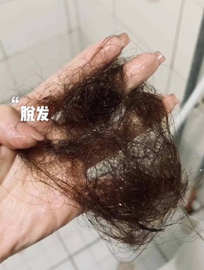 Emc易倍体育：只需三个月摆脱掉发！发量蓬松暴涨的秘诀！效果简直惊人！(图2)