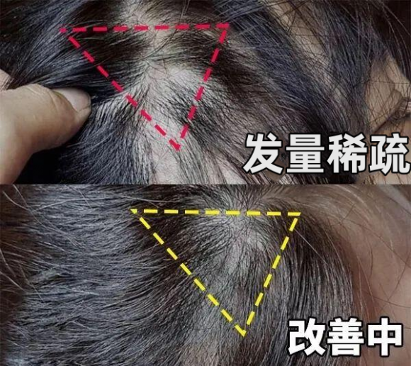 Emc易倍体育：这几个堪比整容的变美习惯你知道吗？(图10)