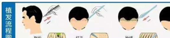 25亿人的烦恼男神女神大佬都躲不过却引爆了千亿市场(图12)