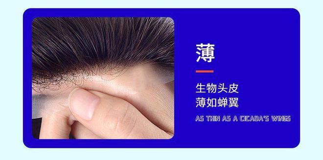 易倍体育网站：假发掉发了可以进行补救吗？（详细诠释）(图3)