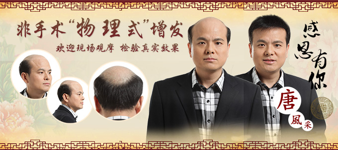 Emc易倍体育：戴真人假发也有禁忌？经常戴假发这三件事一定要注意！(图5)