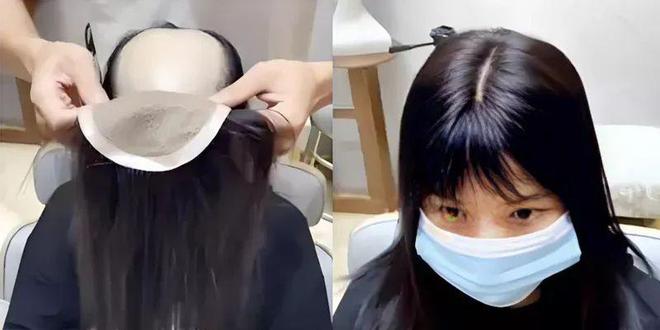 Emc易倍体育：英瑞假发丨专业假发定制技术：匠心独运重塑美丽(图4)