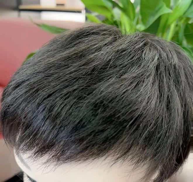 Emc易倍体育：英瑞假发丨专业假发定制技术：匠心独运重塑美丽(图2)