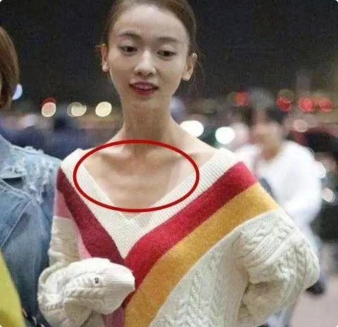 秃头脸凹身瘦如柴从吴谨言到金晨被无效瘦身反噬的女星好多(图10)