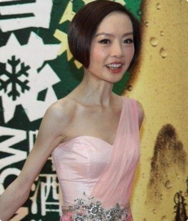 秃头脸凹身瘦如柴从吴谨言到金晨被无效瘦身反噬的女星好多(图12)