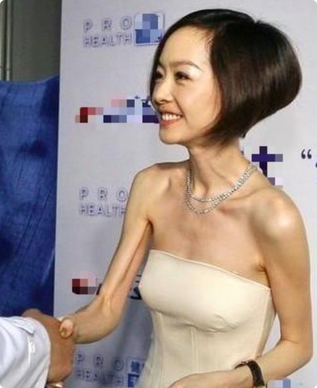 秃头脸凹身瘦如柴从吴谨言到金晨被无效瘦身反噬的女星好多(图11)