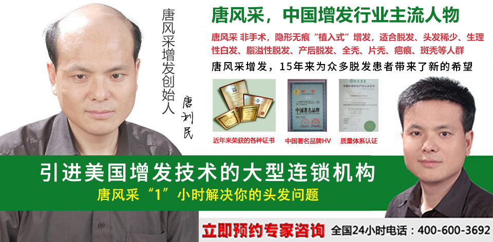 宁波哪里卖真人发假发？(图1)