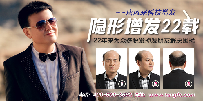 易倍体育网站：真人发假发怎么辨别？告诉你一个简单方法轻松分辨超实用！(图8)