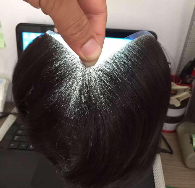 真发假发头顶补发片用什么做的？(图2)