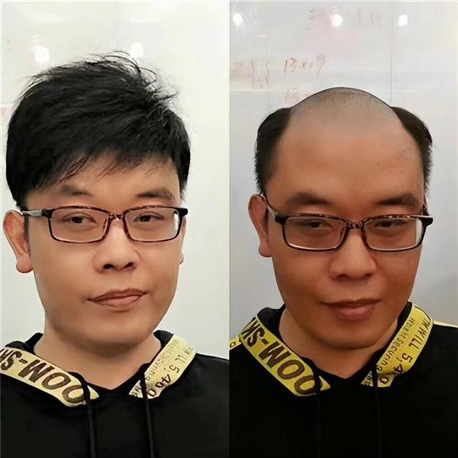 农村经常有人高价收头发这些头发最后都去哪了？(图7)