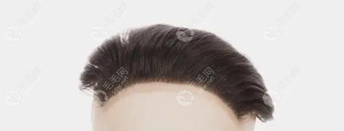 接头发对自己的头发有伤害吗？我接发后咋感觉越来越少(图2)