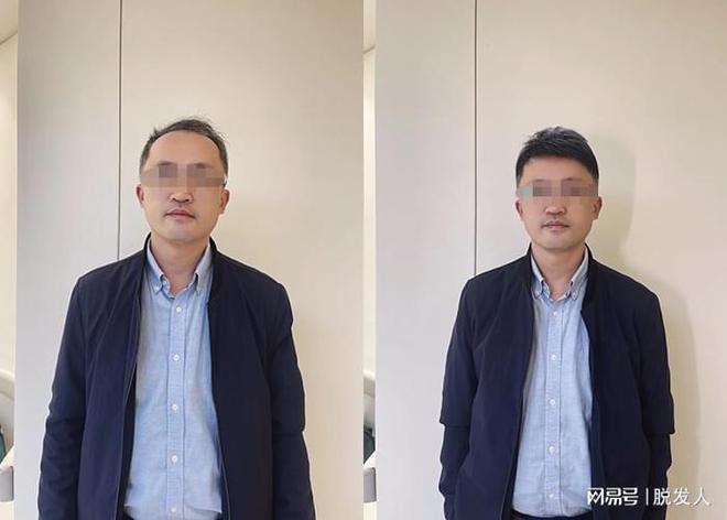 想买到好的假发？看看需要多少钱(图2)
