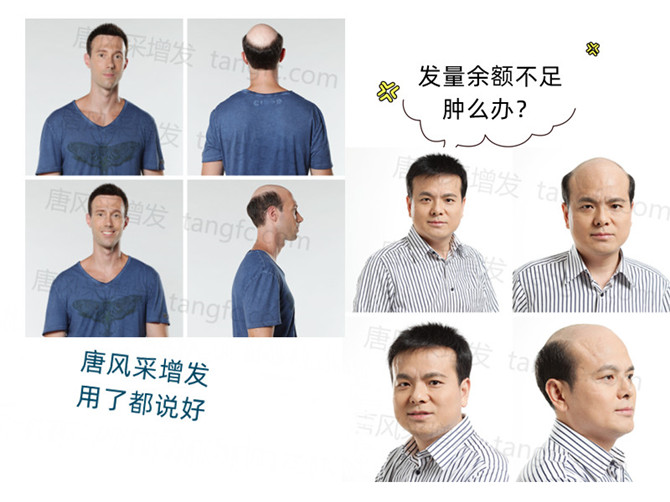 线招教你买到好假发(图3)