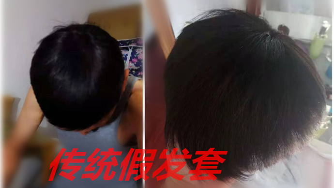 真人发丝男士假发品牌改变脱发形象真的就如此简单(图3)