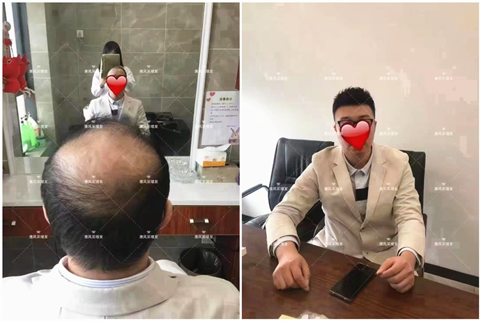 真人发丝男士假发品牌改变脱发形象真的就如此简单(图4)