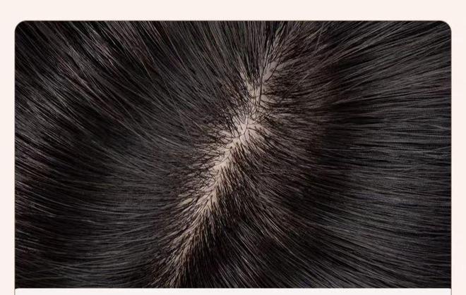 如何挑选适合自己的头顶补发片？(图4)