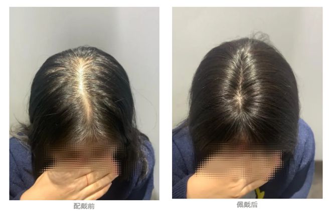 易倍体育网站：时尚界的“六边形战士”守护发量秘密的最佳拍档(图3)