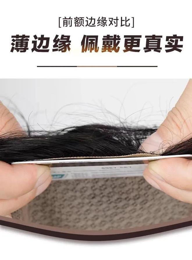 拯救发际线脱发严重假发VS植发怎么选？(图3)