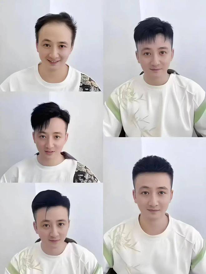 假发购买攻略定制假发多少钱？如何选购？(图4)