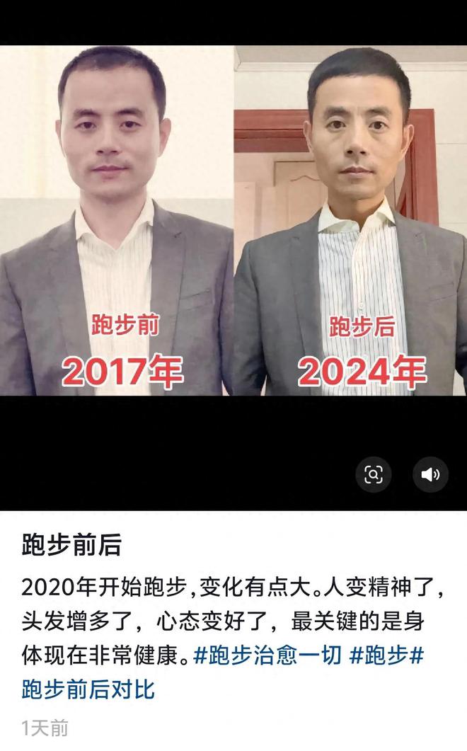 网友晒出七年跑步变化头发增多人变老难道跑步真的会变老(图1)