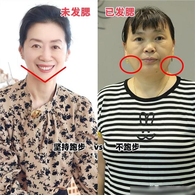 网友晒出七年跑步变化头发增多人变老难道跑步真的会变老(图8)