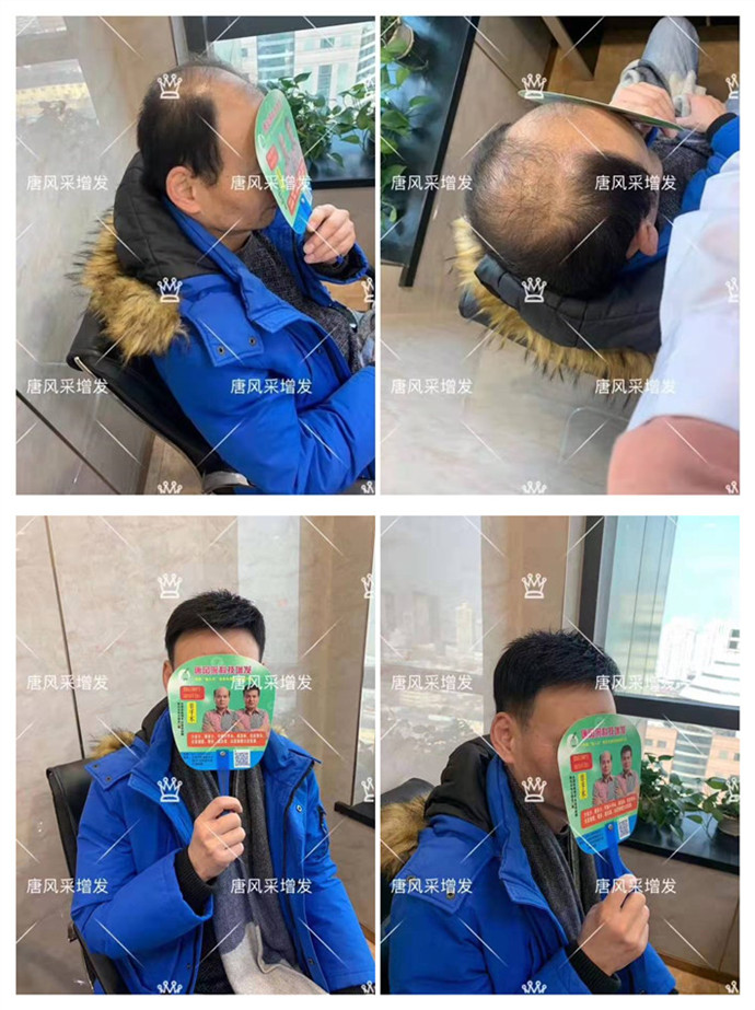 真人假发品牌哪个好？假发想要戴出门这点务必要注意！(图2)