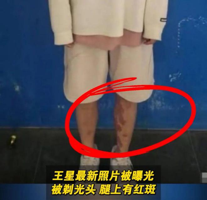 Emc易倍体育：从泰缅安全归国的演员王星最新采访：透露被骗细节被转卖三家公司！(图4)