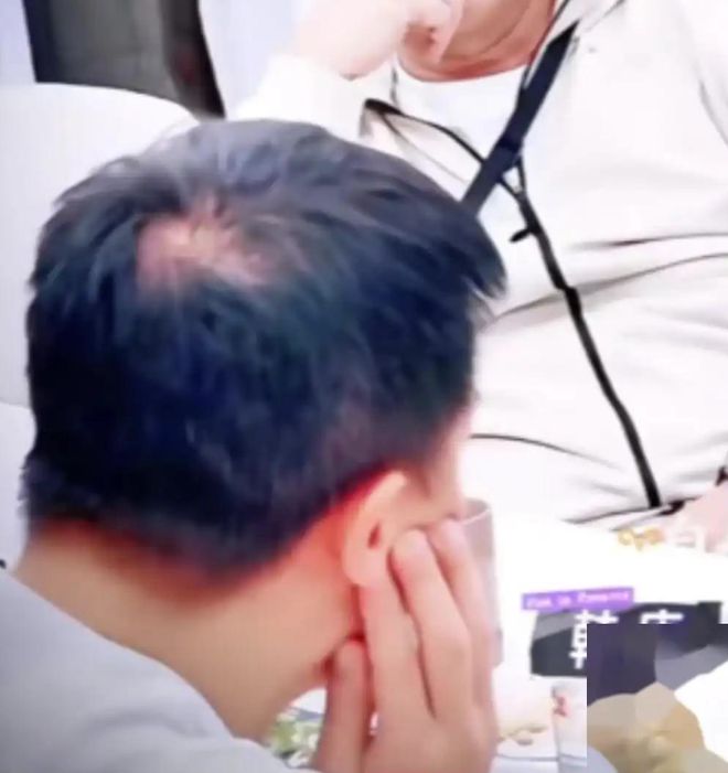 41岁韩庚忘戴假发参加节目头顶秃了一大片断崖式衰老引热议(图7)
