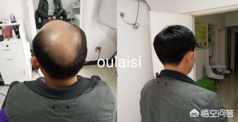 假发怎么买？(图3)