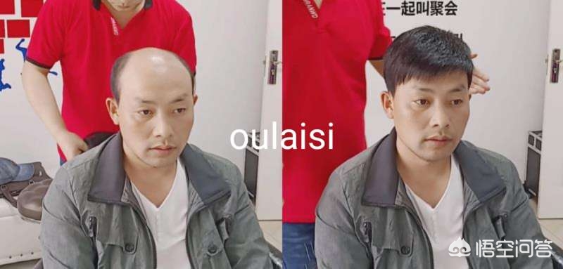 假发怎么买？(图2)