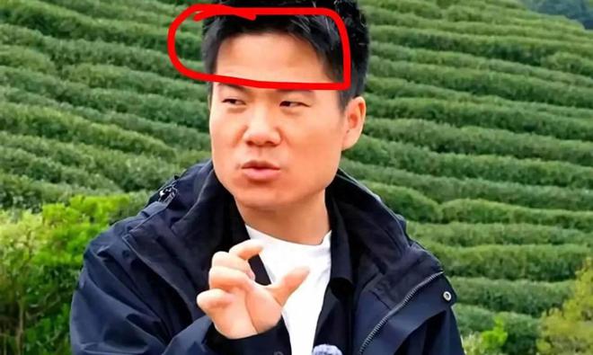 董宇辉在杭州助农直播时额头上再一次出现了明显的“伏羲骨”(图4)