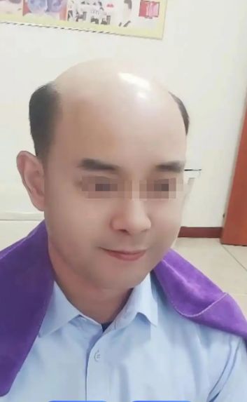 秃顶男子花8000买假发洗澡忘摘结果假发滴血警方：这是硬扯下的(图1)