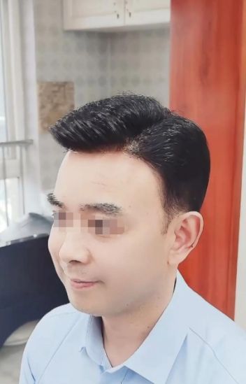 秃顶男子花8000买假发洗澡忘摘结果假发滴血警方：这是硬扯下的(图2)