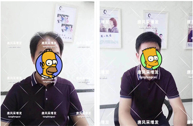 Emc易倍体育：买真发做的假发这两个事项你一定要注意！(图2)