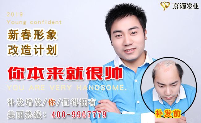 假发价格差异为什么那么大？京源真人发假发定做(图1)
